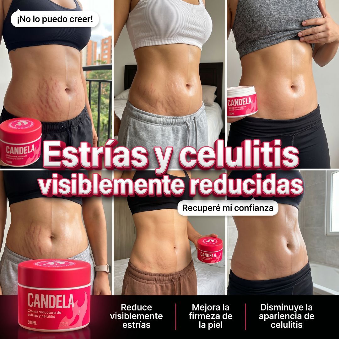 Crema Candela, Elimina estrias y Celulitis al 100%