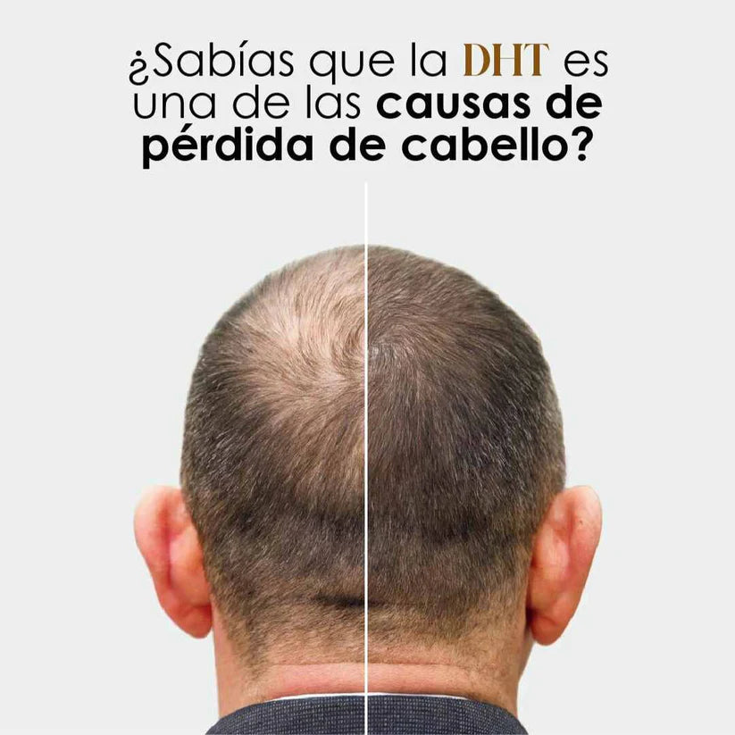 🔹 DHT Blocker Premium – Detén la Caída y Recupera tu Cabello