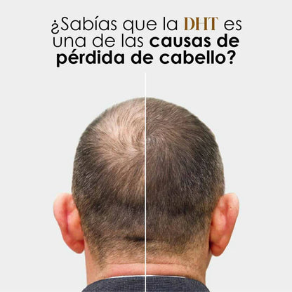 🔹 DHT Blocker Premium – Detén la Caída y Recupera tu Cabello
