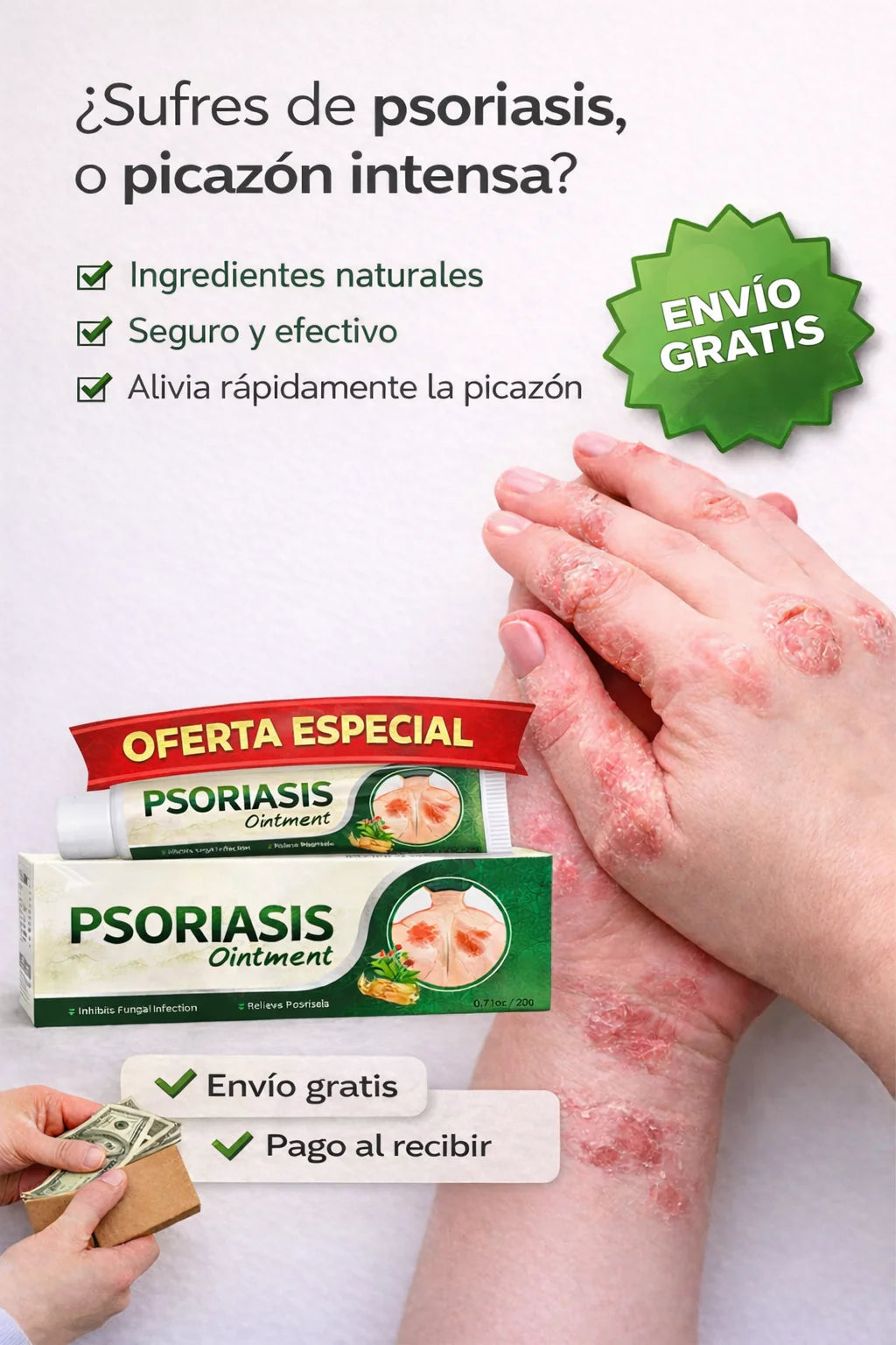 🔥 PSORIASIS™ | Alivio inmediato de picazón y enrojecimiento ✨