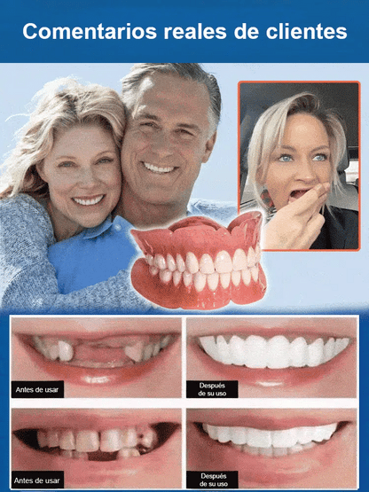 Sonrisa Total Premium: Prótesis Dental Completa de Alta Gama