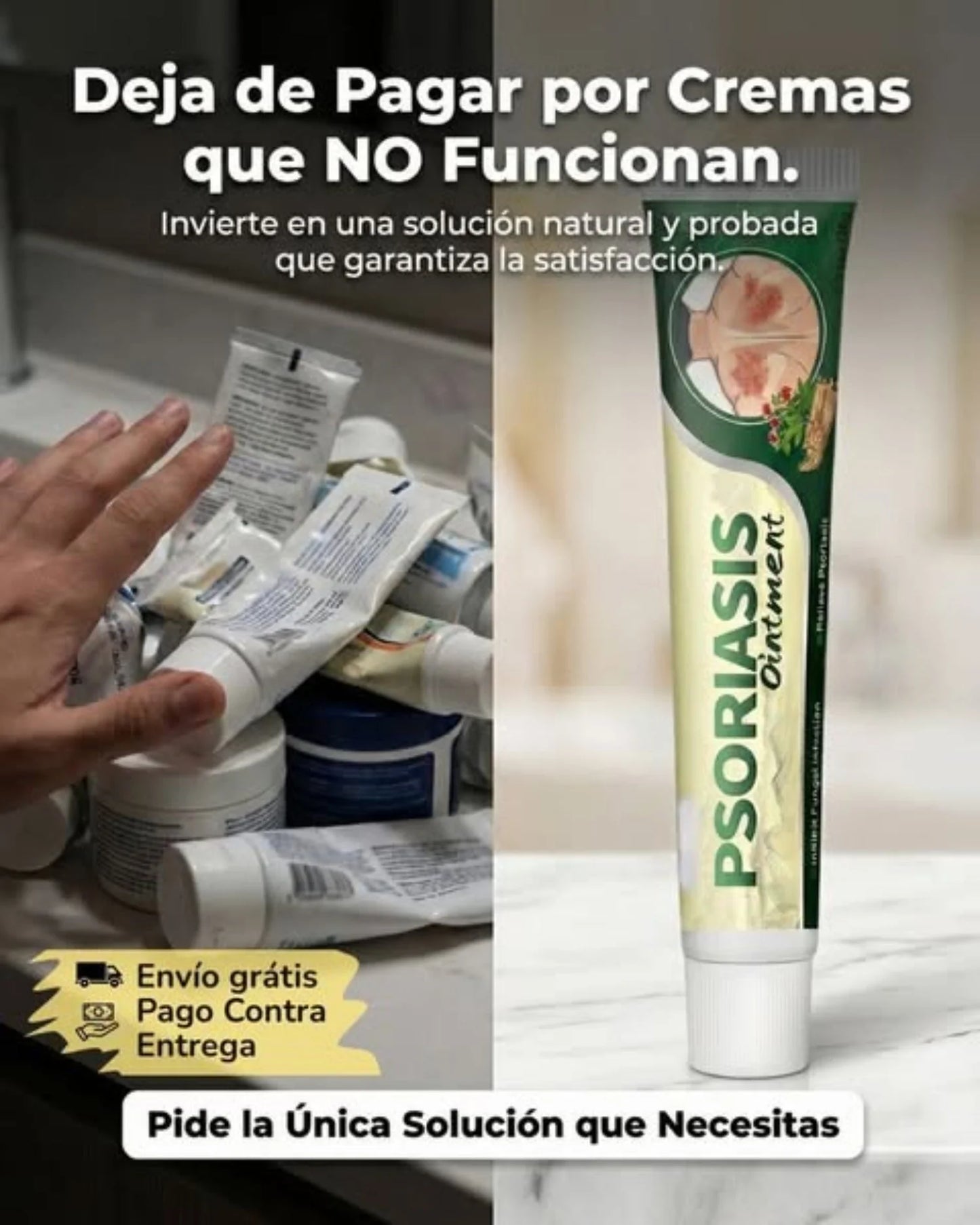 🔥 PSORIASIS™ | Alivio inmediato de picazón y enrojecimiento ✨