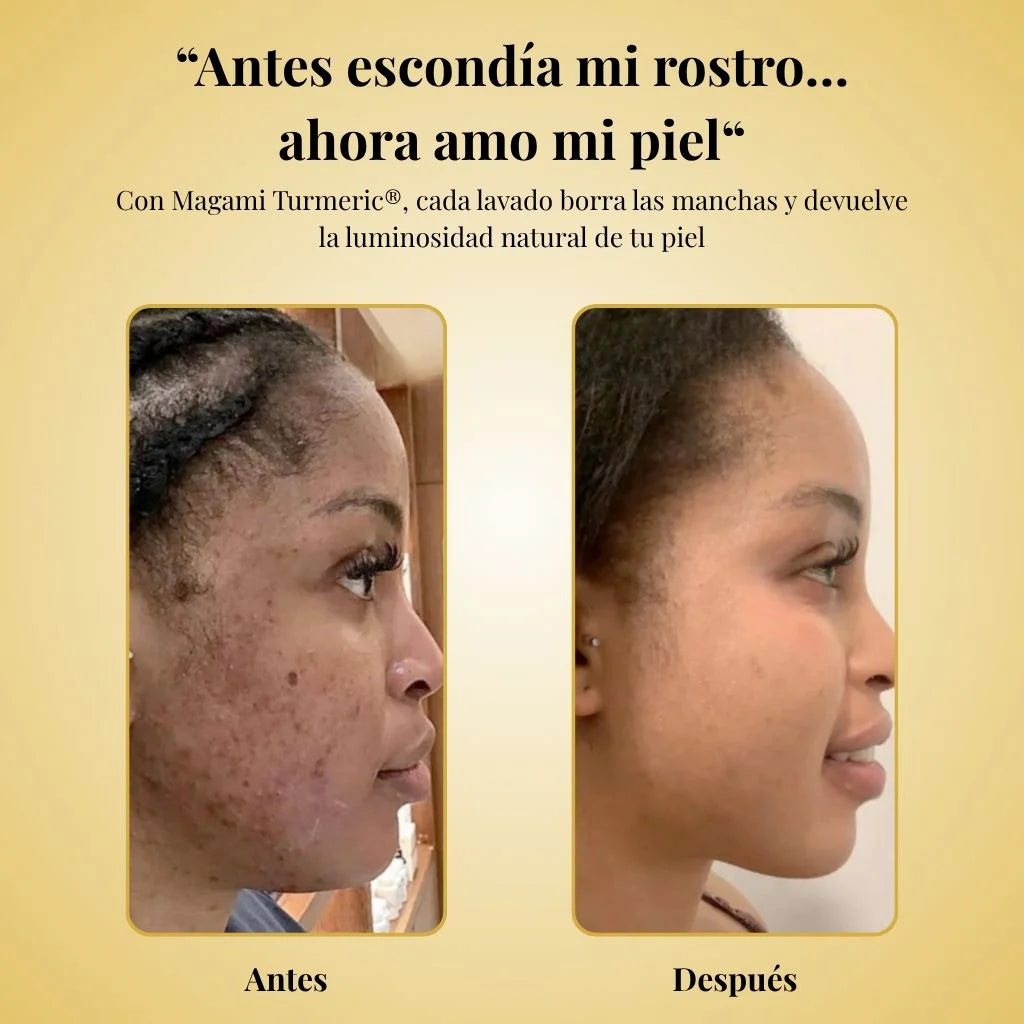 CurSoap™ - Jabón de Cúrcuma Natural 🧼🍂