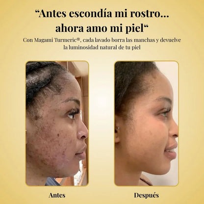 CurSoap™ - Jabón de Cúrcuma Natural 🧼🍂