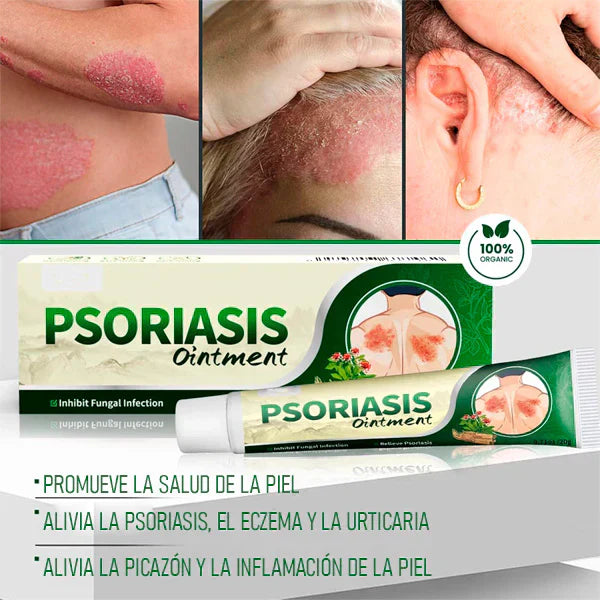 🔥 PSORIASIS™ | Alivio inmediato de picazón y enrojecimiento ✨