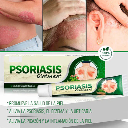 🔥 PSORIASIS™ | Alivio inmediato de picazón y enrojecimiento ✨