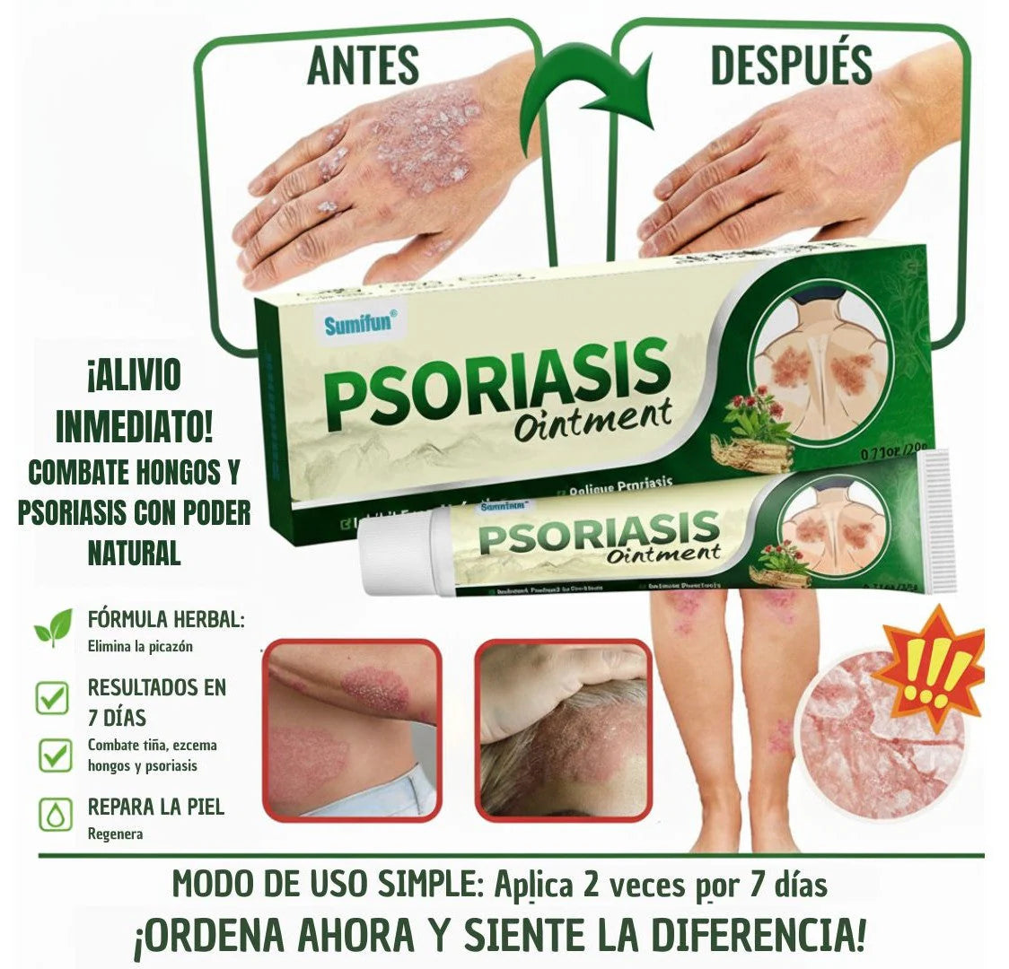 🔥 PSORIASIS™ | Alivio inmediato de picazón y enrojecimiento ✨