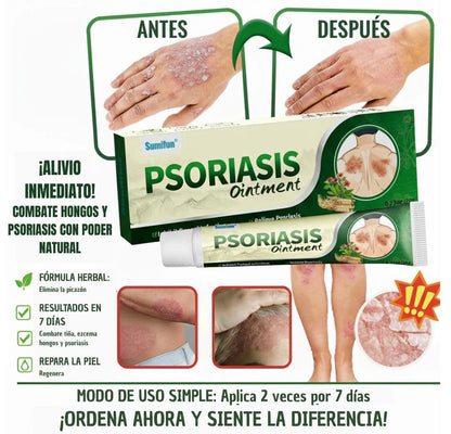 🔥 PSORIASIS™ | Alivio inmediato de picazón y enrojecimiento ✨