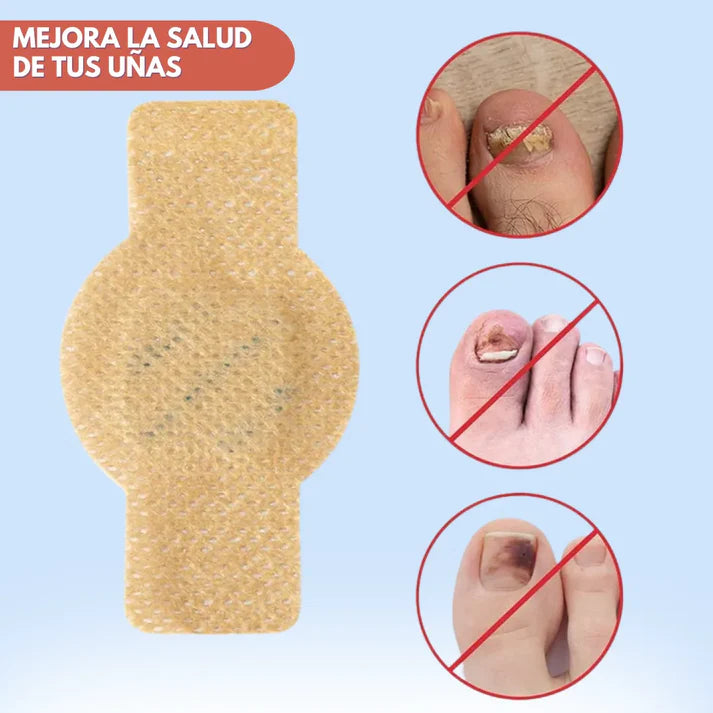 DermaPatch™ Parche Antifúngico para Hongo