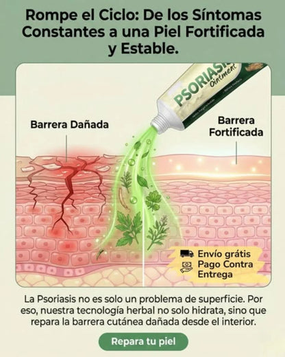 🔥 PSORIASIS™ | Alivio inmediato de picazón y enrojecimiento ✨