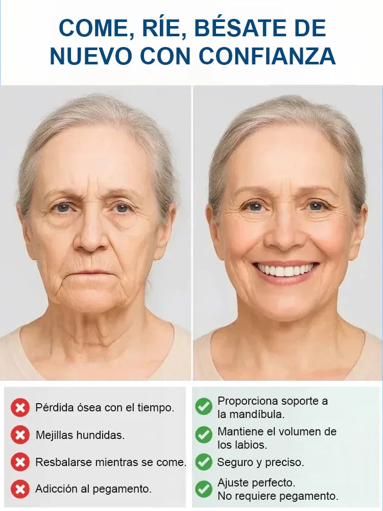 PROTESKIT™ – Prótesis Dental Completa con Soporte Esquelético (Sonrisa Firme y Natural)