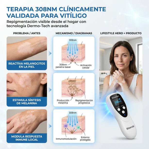 Dispositivo de terapia para el vitíligo DermaBeam