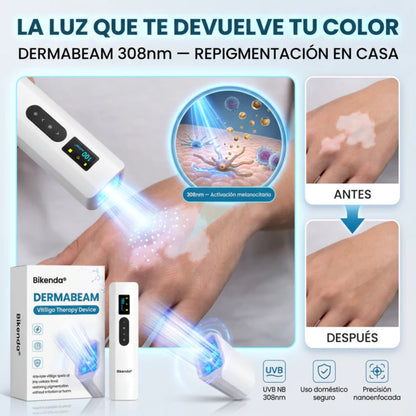 Dispositivo de terapia para el vitíligo DermaBeam
