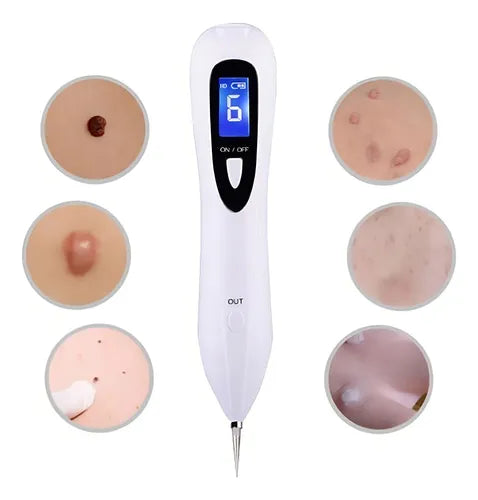 🔥 Di adiós a las imperfecciones al instante con el Cauterizador Pro 😍