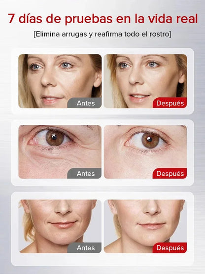 😱 Arrugas Fuera en Minutos – Crema Lifting Importada de EE. UU. ⭐⭐⭐⭐⭐